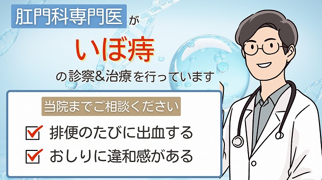 いぼ痔(内痔核・外痔核)